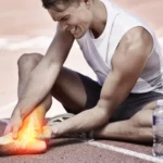 Kontuzja sportowa